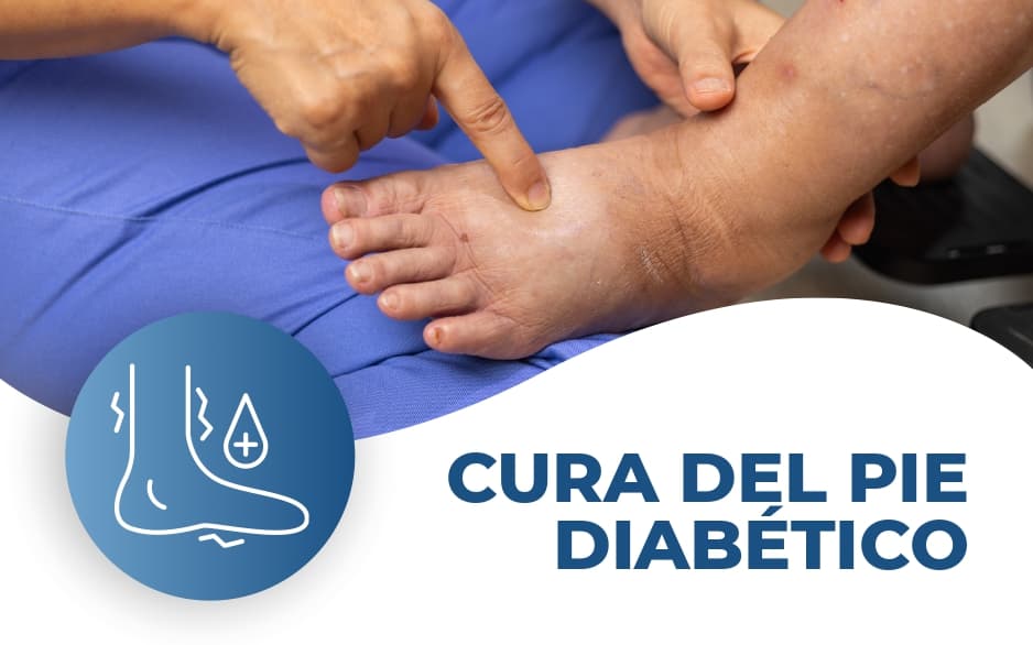 Cura del Pie Diabético